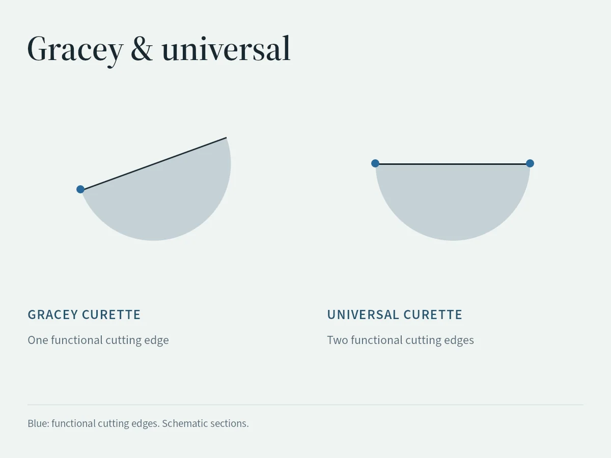Schematic sections compare a universal curette with a Gracey curette and highlight their functional cutting edges.