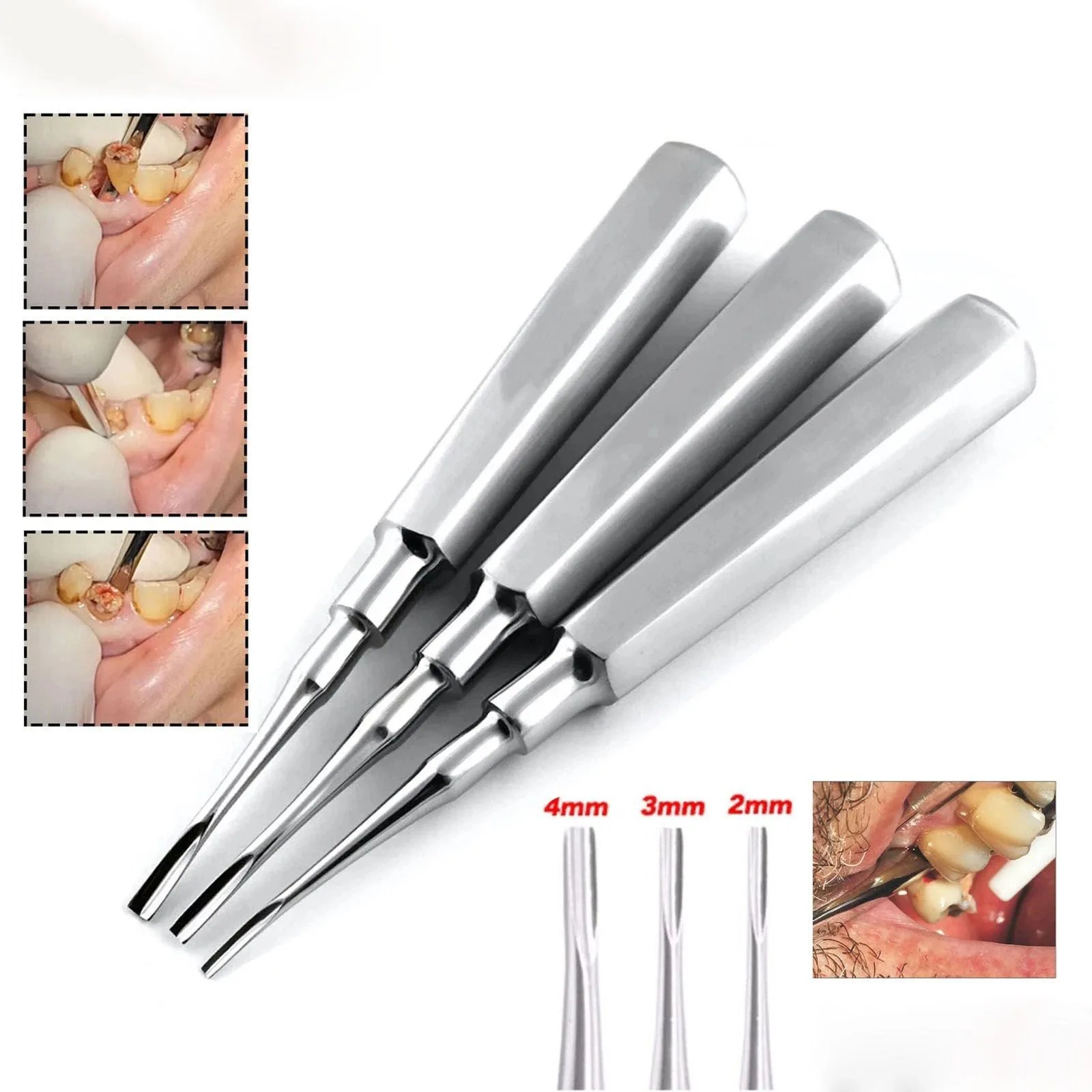 Three Coupland straight elevators with tip-size and working-end insets